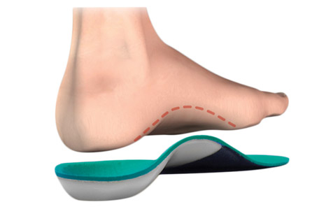 Custom Orthotics, flat feet, heel pain, arch pain, custom orthotics Woodbridge, custom orthotics Vaughan